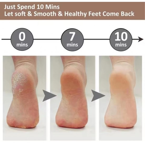 Şarjlı Pedikür Ayak Törpüsü